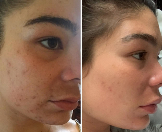 Before & After